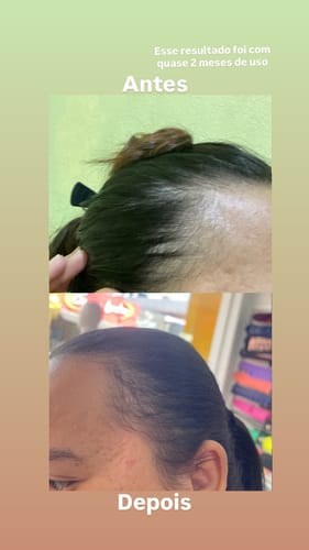 Cliente com produto Happy Hair